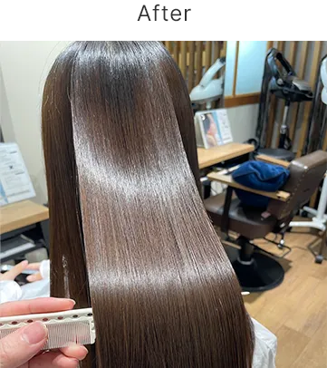 リプレックス 施術ビフォーアフター