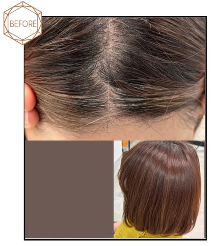 Before<br />