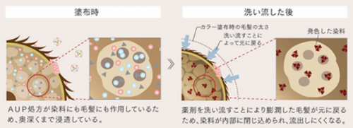 AUP処方